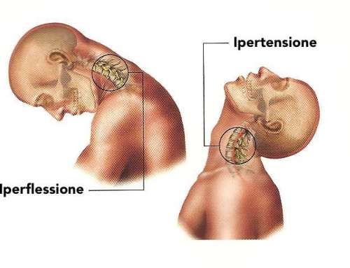 Consigli per il benessere del rachide cervicale